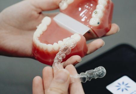 invisalign-como-funciona